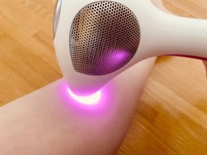 トリアで脱毛する様子